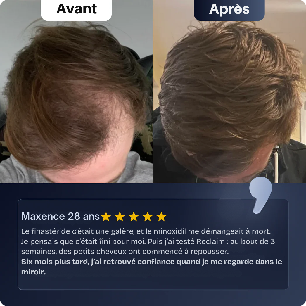 Reclaim - Sérum repousse cheveux