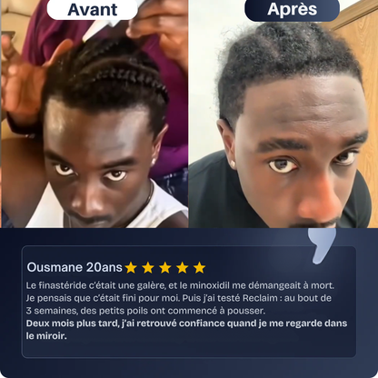 Reclaim - Sérum repousse cheveux